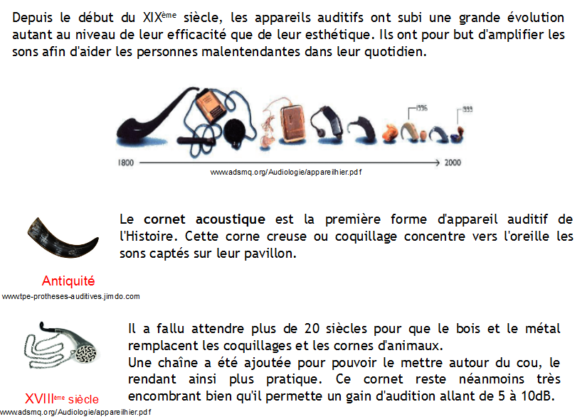 Appareils auditifs 1