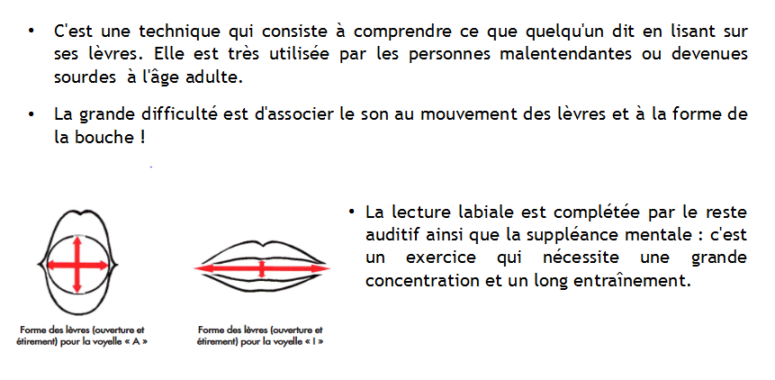 Capture l l